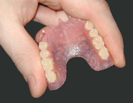 Flexible Denture